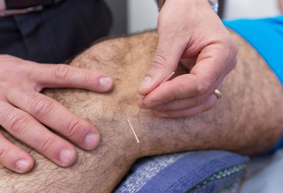 The Treatment Of Acupuncture