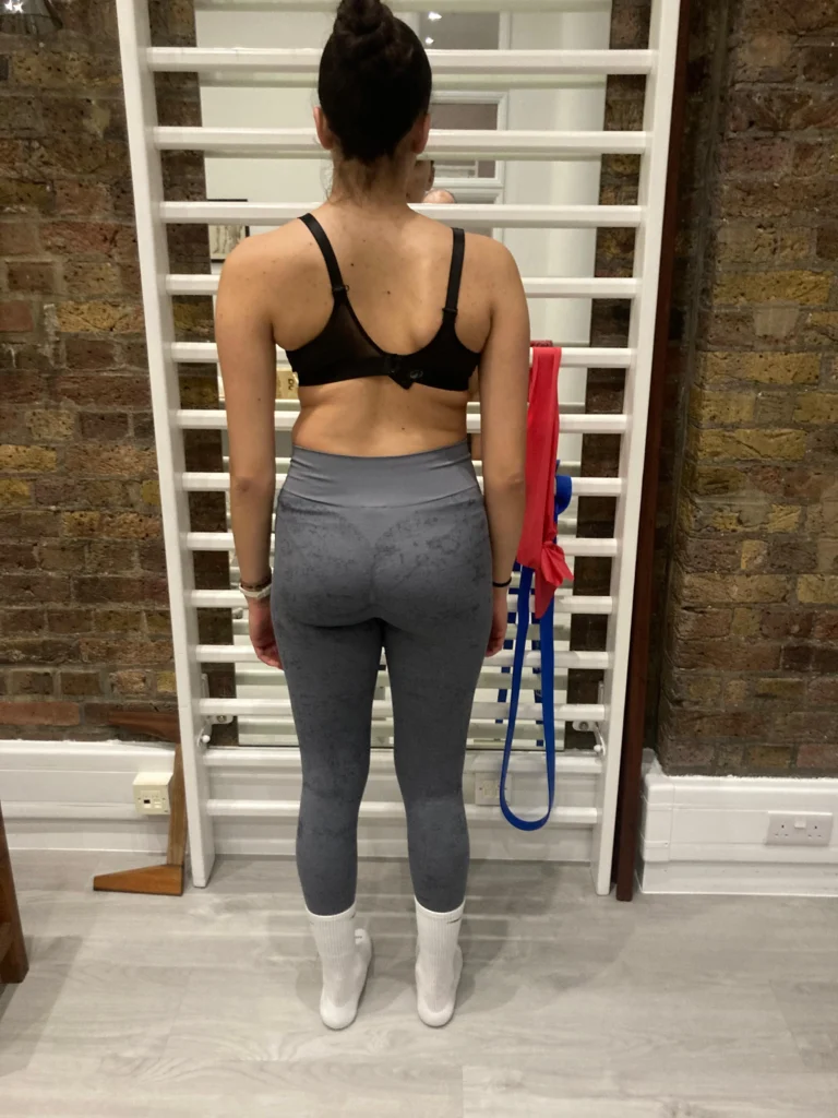 Scoliosis & Schroth Treatment