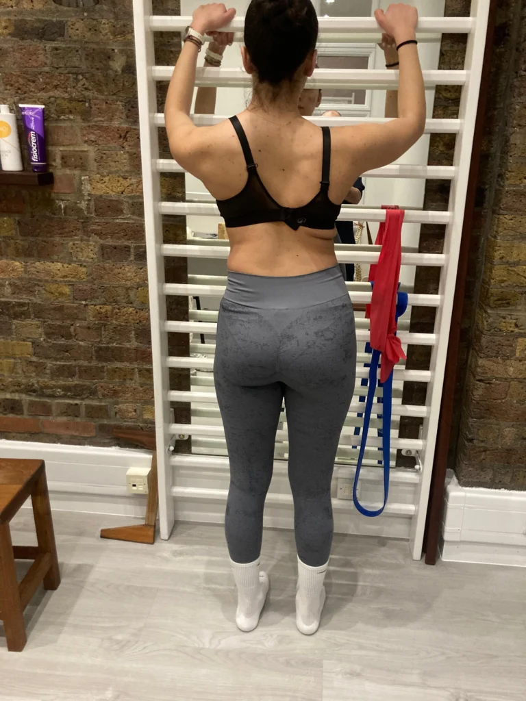Scoliosis & Schroth Treatment