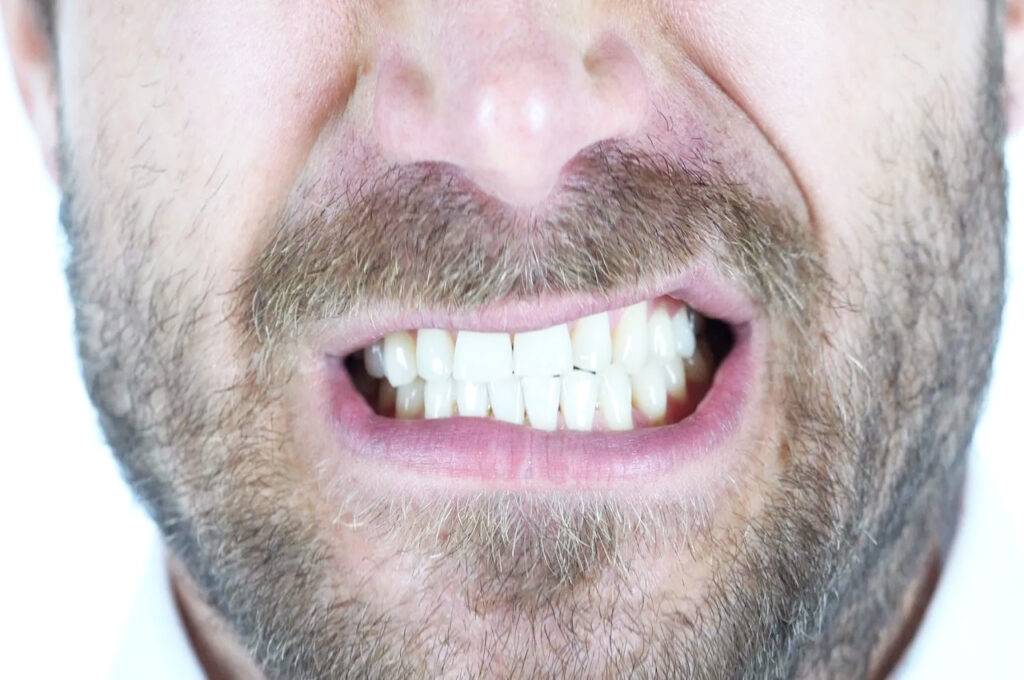 teeth-grinding